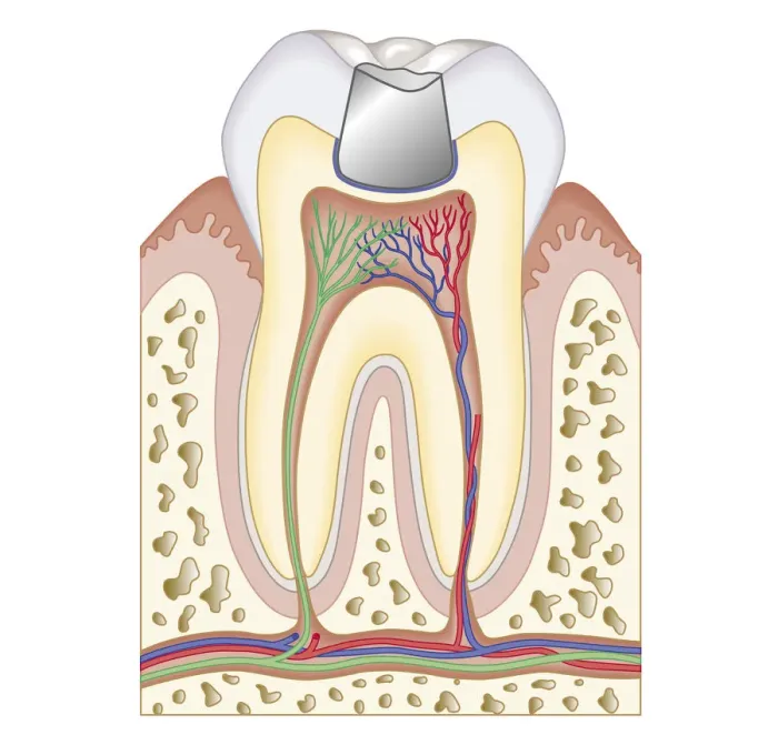 Framed Print : Cross section biomedical illustrationBiomedical illustration of dental filling Framed Print : Cross section biomedical illustrationBiomedical illustration of dental filling
