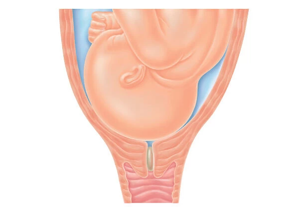 Cross section digital illustration of head of foetus in pelvis, pushing against cervix as labour nears, also showing mucus plug in cervix