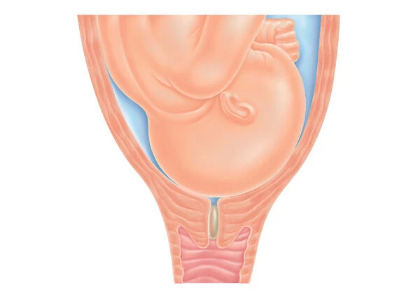 Cross section digital illustration of head of foetus in pelvis, pushing against cervix as labour nears, also showing mucus plug in cervix