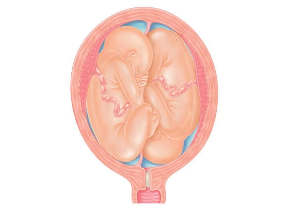 Cross section digital illustration showing normal and breech positions