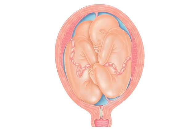 Cross section digital illustration of twins in breech position with buttocks presented first