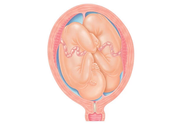 Cross section digital illustration of twins in normal position in uterus