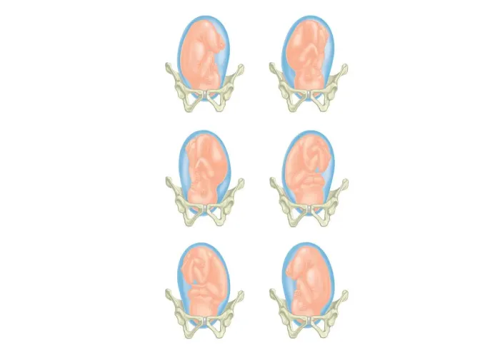 Framed Print : Six cross section digital illustrations of foetus showing position head in pelvis Framed Print : Six cross section digital illustrations of foetus showing position head in pelvis