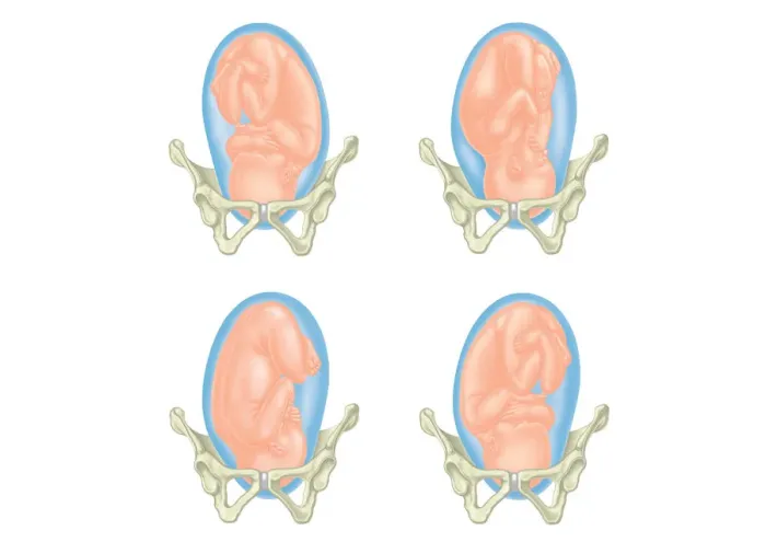 Framed Print : Four cross section digital illustrations showing head of foetus in pelvis Framed Print : Four cross section digital illustrations showing head of foetus in pelvis