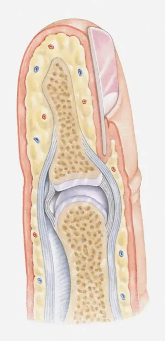 Framed Print : Cross section illustration of human finger Framed Print : Cross section illustration of human finger