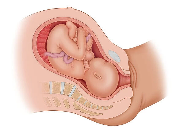 Cross section of the mothers anatomy showing the baby in uteruo ROP
