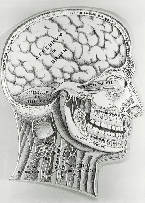 Framed Print : Cross Section Picture of the Human Brain Framed Print : Cross Section Picture of the Human Brain