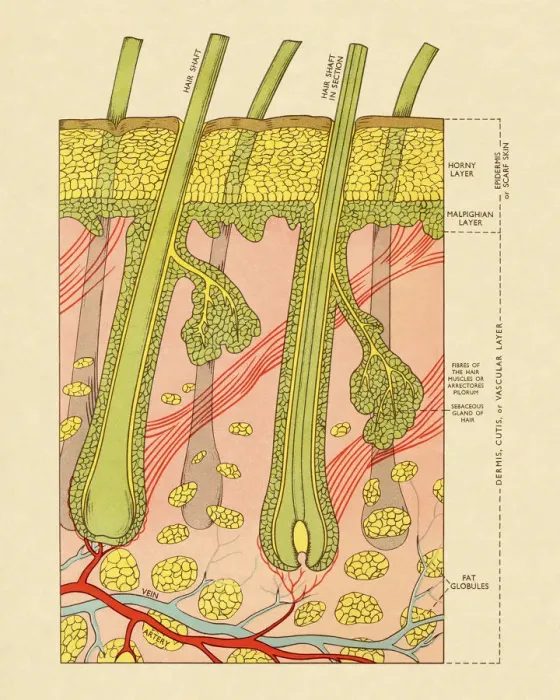 Framed Print : Cross Section of Skin With Hair Follicles Framed Print : Cross Section of Skin With Hair Follicles