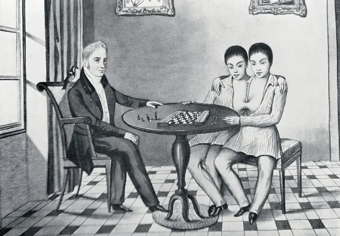 Framed Print : Depiction of Siamese Twins Playing Chess Framed Print : Depiction of Siamese Twins Playing Chess