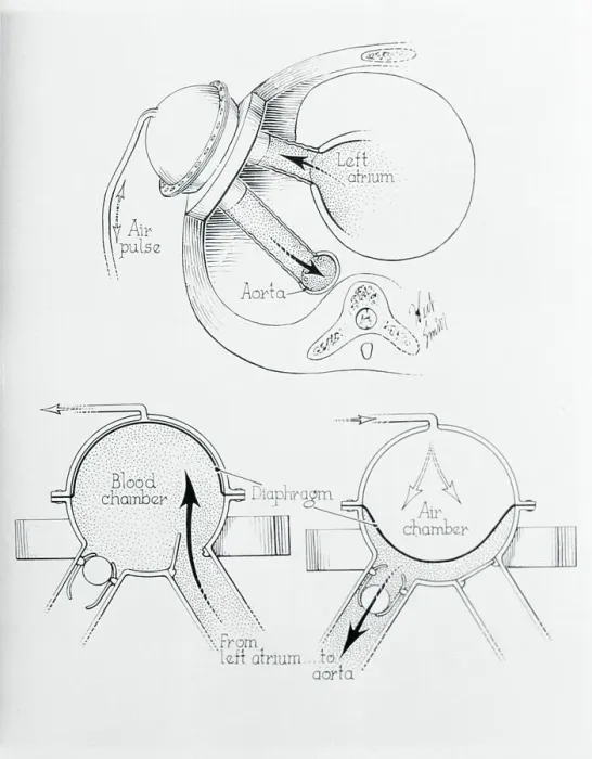 Framed Print : Diagram of Artificial Heart Compression Framed Print : Diagram of Artificial Heart Compression