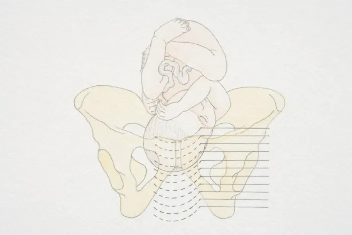 Framed Print : Diagram of womans pelvis and curled up foetus Framed Print : Diagram of womans pelvis and curled up foetus