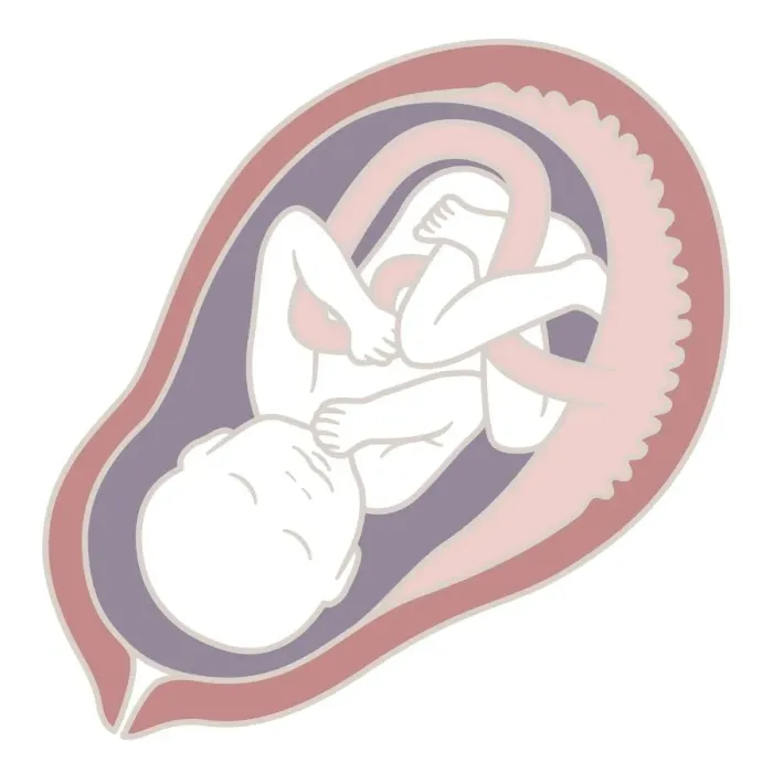 Framed Print : Digital illustration of 32 week old human foetus in uterus Framed Print : Digital illustration of 32 week old human foetus in uterus