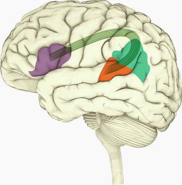 Digital illustration of Bocas area (purple), Wernickes area (orange), Geschwinds territory (turquoise) and arcuate fasciculus (green) in human brain