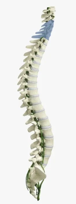 Framed Print : Digital illustration of human spine with damaged area highlighted in blue resulting in quadriplegia Framed Print : Digital illustration of human spine with damaged area highlighted in blue resulting in quadriplegia