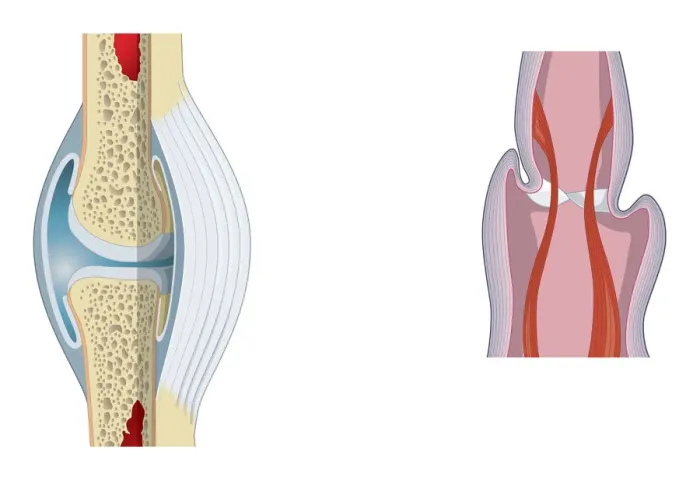 Framed Print : Digital illustration of invertebrate joint, left, and vertebrate joint, right Framed Print : Digital illustration of invertebrate joint, left, and vertebrate joint, right