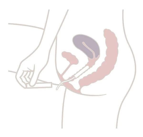 Digital illustration of tampon correctly positioned in vagina