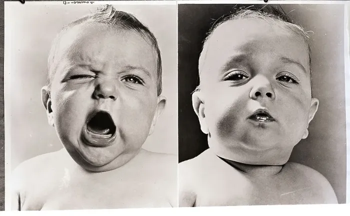Framed Print : Diptych of Two Babies