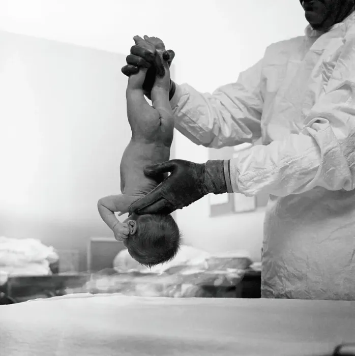 Framed Print : Doctor holding newborn baby upside-down by it's ankles slapping it's bottom to start it breathing, rear view Framed Print : Doctor holding newborn baby upside-down by it's ankles slapping it's bottom to start it breathing, rear view
