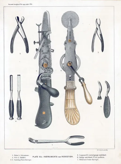 Framed Print : Doctors Instruments In 19Th Century Framed Print : Doctors Instruments In 19Th Century