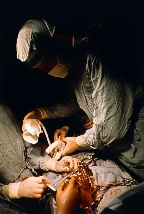 Framed Print : Doctors Perform a Mechanical Heart Transplant Framed Print : Doctors Perform a Mechanical Heart Transplant