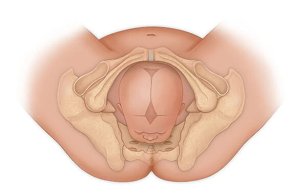 Doctors view of a baby in occipital anterior position ready for delivery