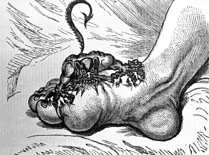 Framed Print : Drawing of The Gout, ca. 1799 Framed Print : Drawing of The Gout, ca. 1799