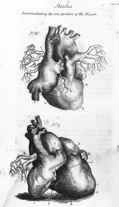 Framed Print : Engraving of Human Heart Framed Print : Engraving of Human Heart