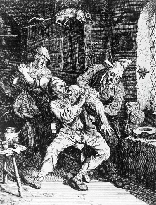 Framed Print : Engraving After A Surgeon Attending to a Man's Arm by Cornelius Dusart Framed Print : Engraving After A Surgeon Attending to a Man's Arm by Cornelius Dusart
