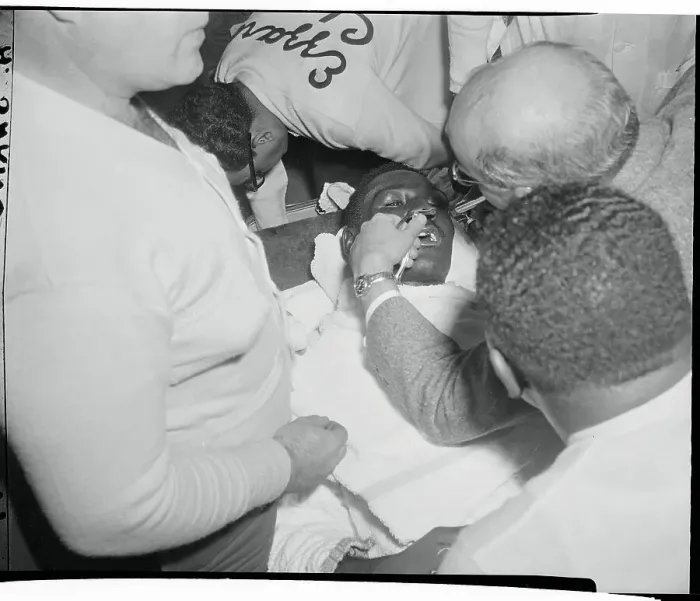 Framed Print : Ezzard Charles Being Checked for Boxing Injury Framed Print : Ezzard Charles Being Checked for Boxing Injury