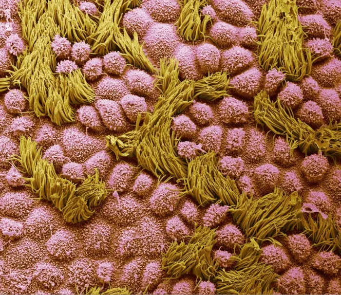 Framed Print : Fallopian tube, SEM Framed Print : Fallopian tube, SEM