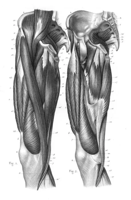 Framed Print : Femoral region anatomy engraving 1866 Framed Print : Femoral region anatomy engraving 1866