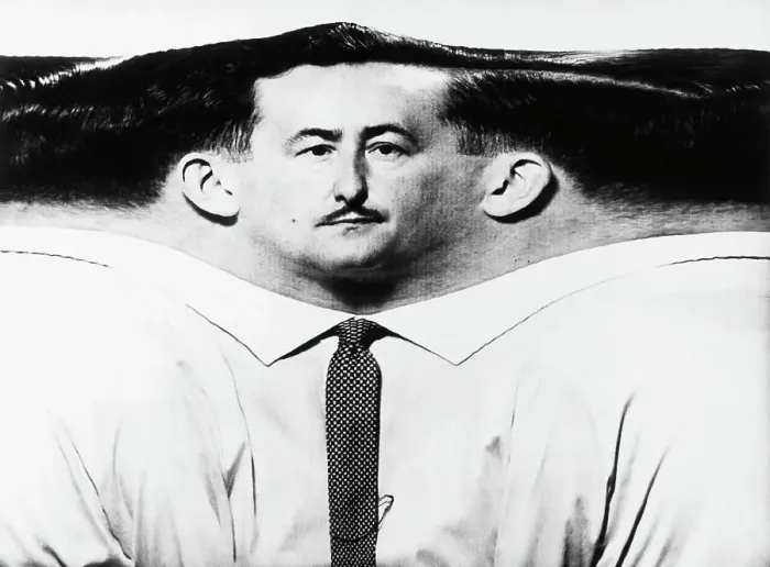 Framed Print : Flattened Periphery of Man's Head Framed Print : Flattened Periphery of Man's Head