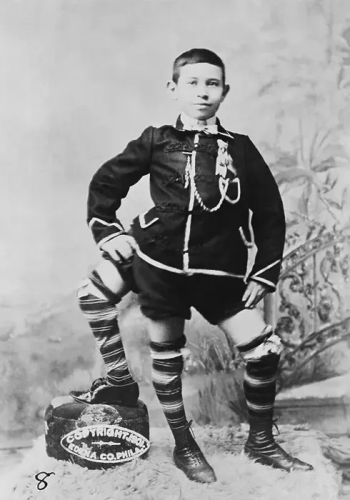 Framed Print : Francis Lentini, Three-Legged Boy Framed Print : Francis Lentini, Three-Legged Boy
