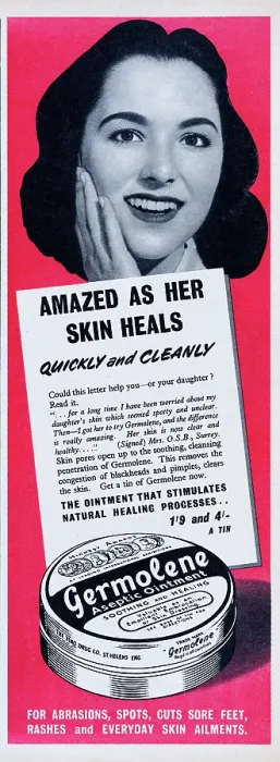 Framed Print : Germolene. 1956: Advertisement for Germolene Aseptic Ointment skin cream Framed Print : Germolene. 1956: Advertisement for Germolene Aseptic Ointment skin cream