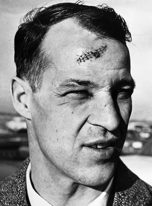 Framed Print : Gordie Howe With Stitches in Head Framed Print : Gordie Howe With Stitches in Head