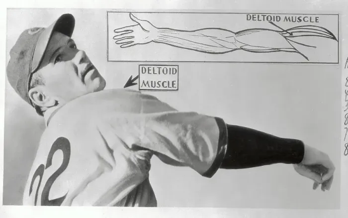 Framed Print : Graph of Jerome Dean's Arm Muscle Framed Print : Graph of Jerome Dean's Arm Muscle