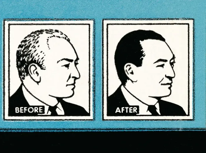 Framed Print : Before and After hair solution