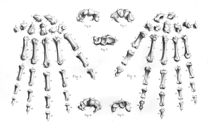 Framed Print : Hand bones anatomy engraving 1866 Framed Print : Hand bones anatomy engraving 1866