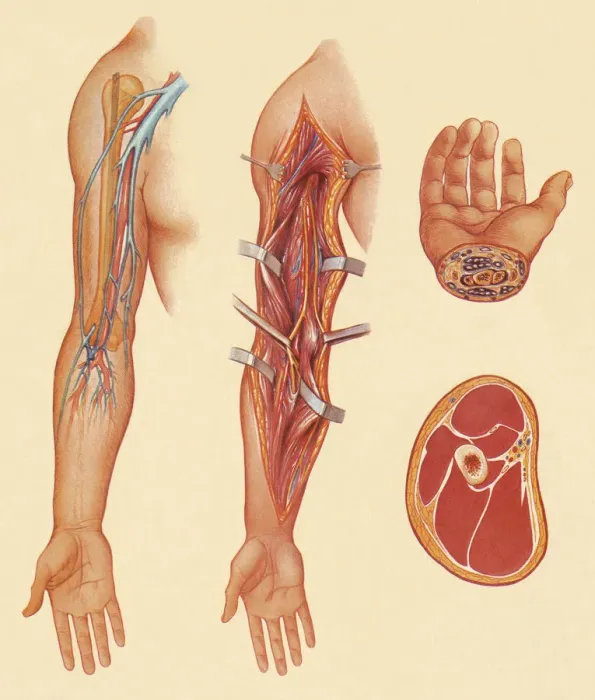 Framed Print : Arm. Hand and Meat Illustration Framed Print : Arm. Hand and Meat Illustration