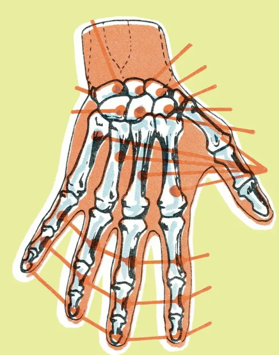 Framed Print : Hand skeleton Framed Print : Hand skeleton
