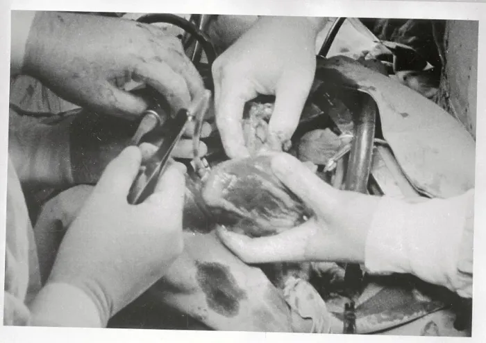 Framed Print : A Heart Transplant Operation Framed Print : A Heart Transplant Operation