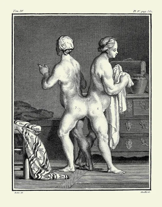 Framed Print : Hélène and Judith, siamese twins Framed Print : Hélène and Judith, siamese twins