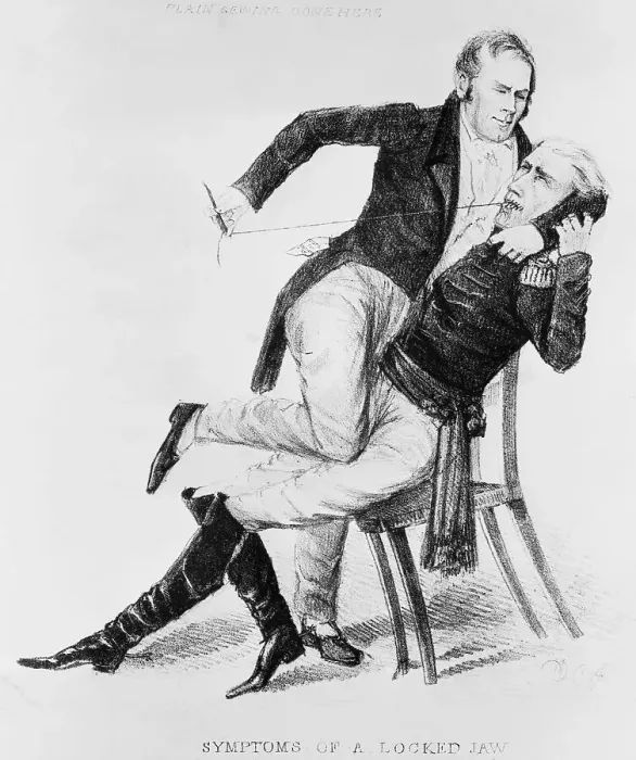 Framed Print : Henry Clay Sewing Andrew Jackson'S Mouth Framed Print : Henry Clay Sewing Andrew Jackson'S Mouth
