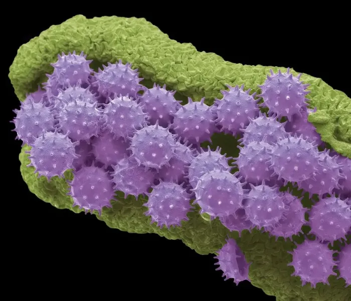 Framed Print : Hibiscus pollen grains, SEM Framed Print : Hibiscus pollen grains, SEM
