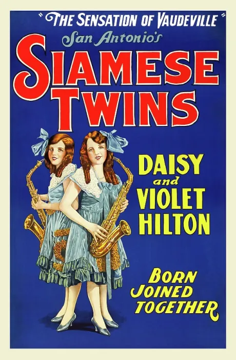 Framed Print : Hilton Sisters - Siamese Twins