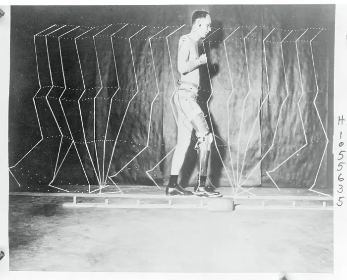 Framed Print : Howard D. Eberhart Demonstrating Prosthetic Movements Framed Print : Howard D. Eberhart Demonstrating Prosthetic Movements
