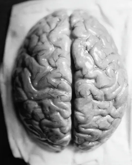 Framed Print : The Human Brain