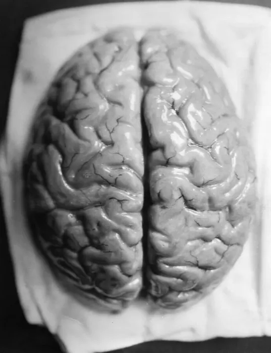 Framed Print : The Human Brain Framed Print : The Human Brain
