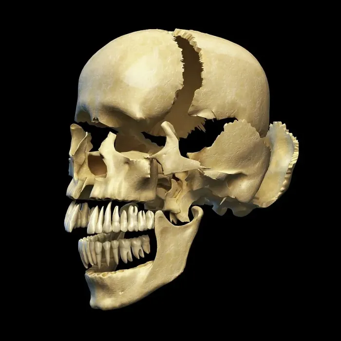 Framed Print : Human skull in sections, artwork