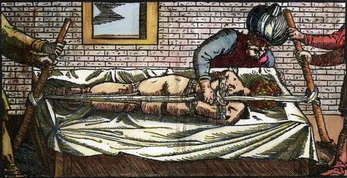 Framed Print : Illustration of Avicenna Straightening a Man's Spine Framed Print : Illustration of Avicenna Straightening a Man's Spine